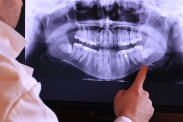 Best Emergency Root Canal Therapy in Tama, IA