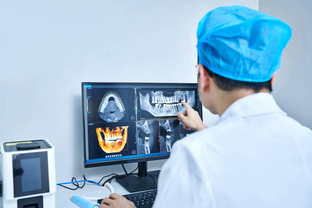 Best Knocked-Out Tooth (Avulsed Tooth) Treatment in Tama, IA