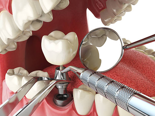 Best Emergency Treatment for Jaw Pain or Injury in Tama, IA